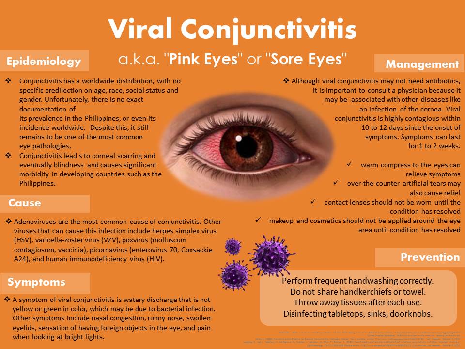 What Is Viral Conjunctivitis A k a Sore Eyes National Institutes Of 